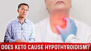Does the Ketogenic Diet Cause Hypothyroidism or Hashimoto’s Thyroiditis – Dr. Berg
