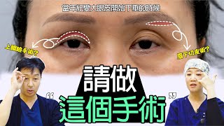 當眼皮下垂時，上眼瞼 VS 眉下切皮術 |最近哪個流行？