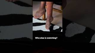 Wendy Williams Lymphedema