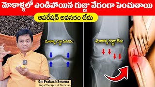 మోకాళ్ళ నొప్పి పోయి లేచి పరుగెడుతారు | Knee Pain Relief | #kneepain || Om Prakash Swarn || Sumantv