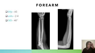 Technique Chart for Radiography Students: kVp, mAs, SID | ARRT Registry Prep