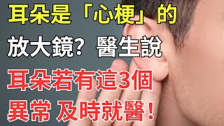 耳朵是「心梗」的放大鏡？醫生說：耳朵若有這3個異常，及時就醫