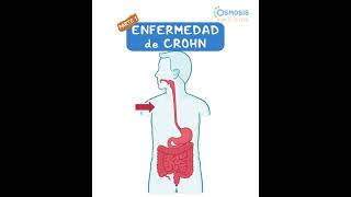 La Enfermedad de Crohn