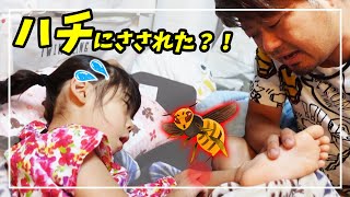 【悲劇🐝】また蜂に！？😢💦娘の足が腫れてた‼️多数の刺された跡が…💦【育児日記】