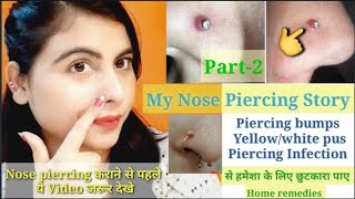 My Nose Piercing Story Part-2 l Nose Piercing Bumps गायब करने का आसान व घरेलू उपाय l Piercing Tips l