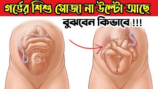 গর্ভের শিশু সোজা না উল্টো হয়ে আছে কিভাবে বুঝবেন? গর্ভে বাচ্চা উল্টে থাকে কেন?Reverse Baby Position