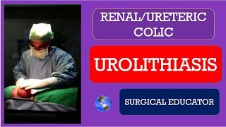 UROLITHIASIS-  How To DIAGNOSE & TREAT /RENAL- URETERIC COLIC