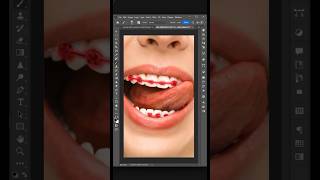 Remove Braces From Your Pictures Generativefill