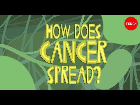 How does cancer spread through the body? - Ivan Seah Yu Jun How does cancer spread through the body? - Ivan Seah Yu Jun