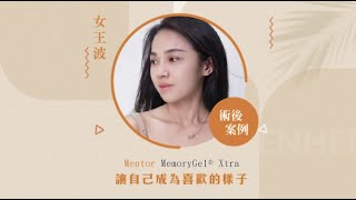 元和雅 #隆乳手術 - 讓自己成為喜歡的樣子，人生苦短，自信才能活得更無憾