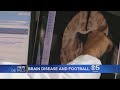 Study Provides More Evidence Of Debilitating Brain Disease Among Football Players