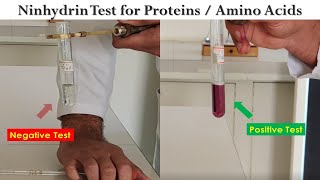 Ninhydrin Test