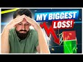 THIS was My Biggest Trading Loss Ever!