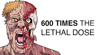 The Worst Radiation Deaths Ever