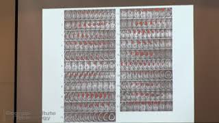 The Modular Brain