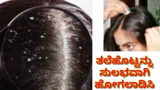 ತಲೆ ಹೊಟ್ಟಿನ ಸಮಸ್ಯೆಗೆ 100% results ಕೊಡುವ ಮನೆಮದ್ದು/Effective home remedy for dandruff/dandruff remedy