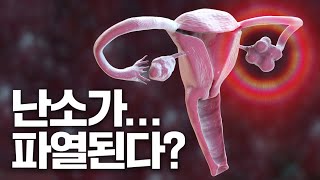 [최상의 지식백과] Q. 난소가... 파열된다?