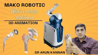 Hip replacement (இடுப்பு  மாற்று) surgery 3d animation- mako robotics- Tamil- Dr Arun Kannan