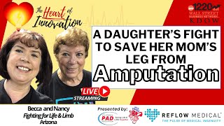 How A Second Opinion and Walking Saved Nancy's Leg From Amputation