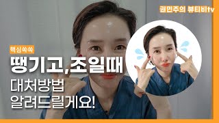 피부 당기고 조일때 🙈 대처방법 알려드릴게요!| 방법 몰라서 난감하셨죠?!🥲인셀덤효과 |인셀덤|인셀덤사용방법