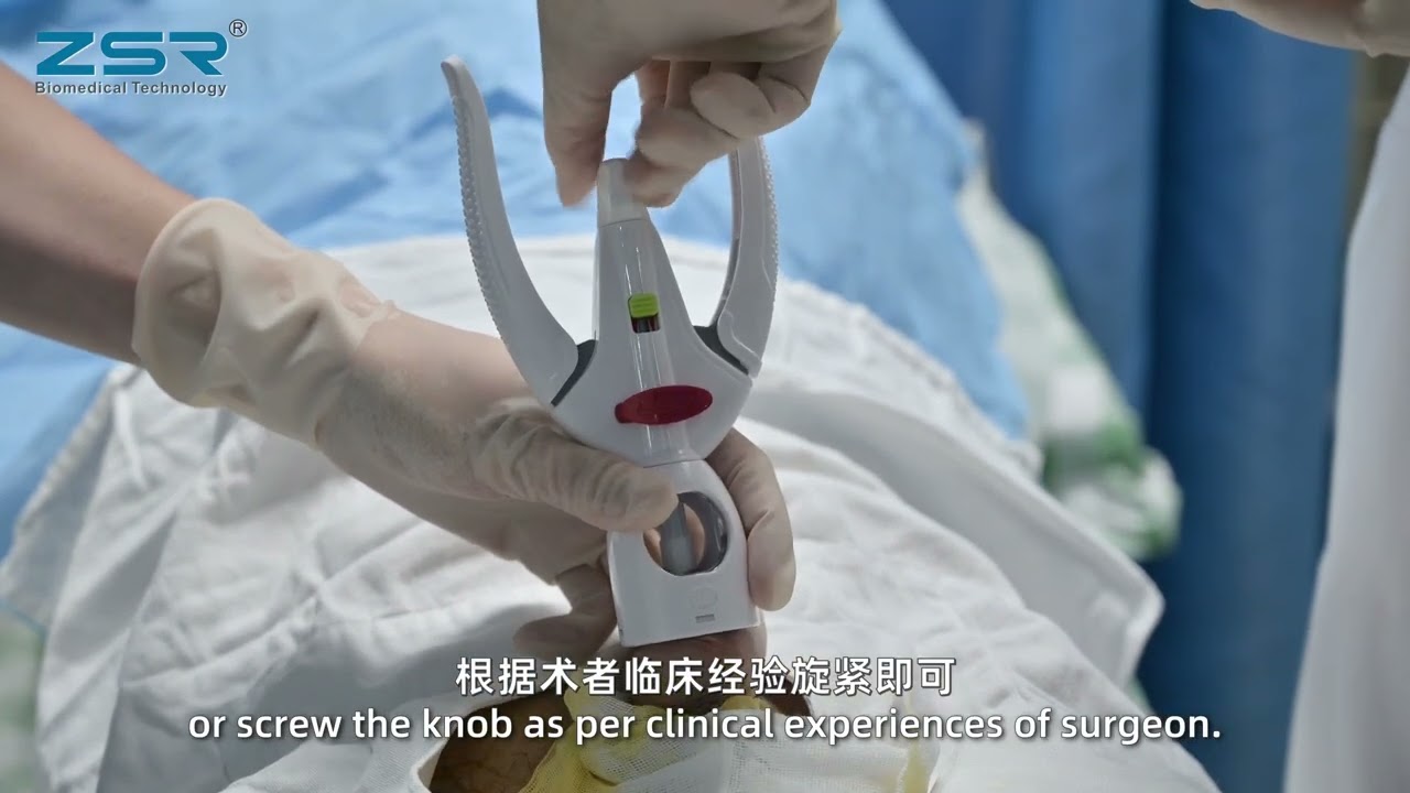Second Generation Zsr Circumcision Device Video Operation Procedure