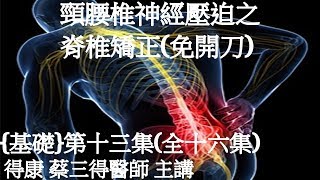 得康自然療法目前三個重點醫療項目之一 ﹝基礎﹞16-13集 頸腰椎側彎椎間盤突出神經壓迫之得康蔡三得醫師脊椎矯正(免開刀)─3.案例分享─(1)腰椎側彎椎間盤突出神經壓迫需開刀三個案例