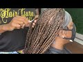 box braids on severe alopecia client top bun knot