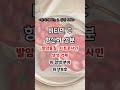 딸기 많이 드세요 딸기의 효능 4가지 알려드립니다 shorts 딸기 건강