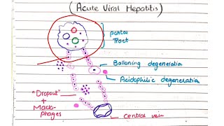 Acute and Chronic Viral Hepatitis | Pathology