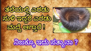 ತಲೆಯಲ್ಲಿ ಎರಡು ಸುಳಿ ಇದ್ದರೆ ಎರಡು ಮದ್ವೆ ಆಗ್ತಾರೆ..!ನಿಜಕ್ಕೂ ಇದು ಸತ್ಯಾನಾ?