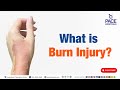 Burn Injury | What is Burn Injury? | #burns #burnsinjury