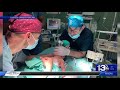 american pediatric cardiac surgery mission covered by wmbb abctv panama city fl