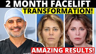 One 49 Year Olds Journey to Looking 10 Years Younger - Plastic Surgery Makeover