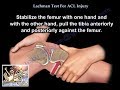 Lachman Test ACL Injury - Everything You Need To Know - Dr. Nabil Ebraheim