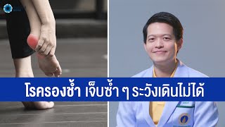 โรครองช้ำ เจ็บซ้ำ ๆ ระวังเดินไม่ได้ | พบหมอมหิดล [by Mahidol Channel]