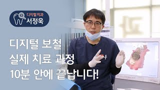 | 디지털 치과 | 실제 디지털 보철 치료 과정 