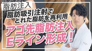 脂肪吸引注射でとれた脂肪を再利用！【脂肪注入】