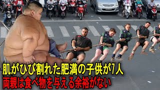 肌がひび割れた肥満の子供が7人、両親は食べ物を与える余裕がない