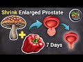 9 Foods to Shrink an Enlarged Prostate
