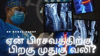 பிரசவத்திற்கு பிறகு #முதுகுவலி? #மயக்கமருந்தும் முதுகு வலியும்!! #டார்க் #மதுரை #பிரசவம்