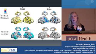 Update on Brain Research in Autism