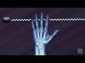 How Does CT Scan Work AD