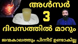 അൾസർ 3 ദിവസത്തിൽ മാറാൻ ഇത് ഒരു ഗ്ലാസ്‌ കുടിക്കുക /Ulcer Malayalam natural home treatment