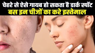 Skin पर है Dark Spot ? इन घरेलू नुस्खों से हो जाएगी क्लियर स्किन