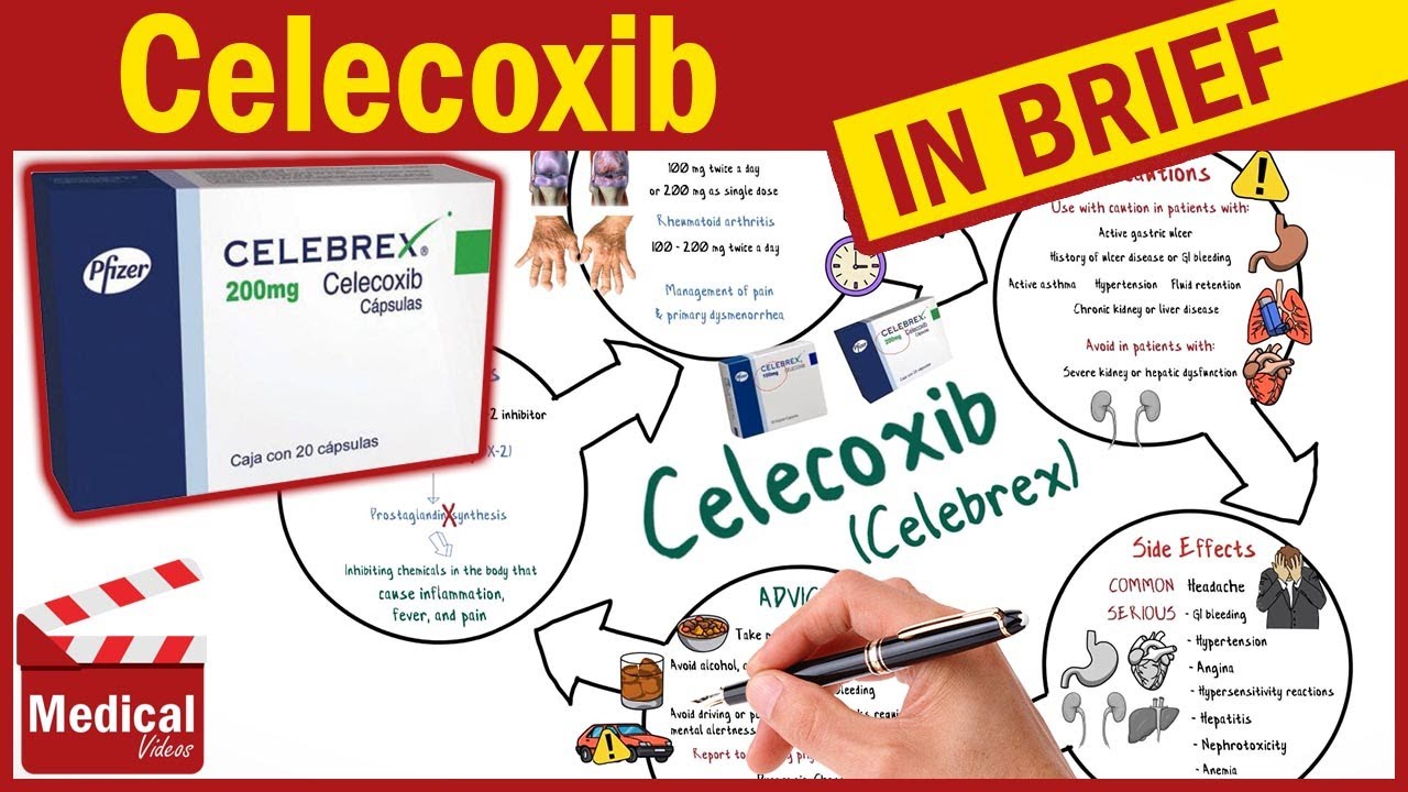 Celecoxib ( Celebrex ): What Is Celecoxib Used For, Dosage, Side ...