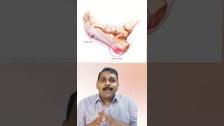 അയ്യോ ഡോക്ടറേ - കുതികാൽ വേദന | Heel pain