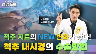 [KNN건강튜브] 볼펜보다 작은 크기의 내시경으로 척추치료를한다?