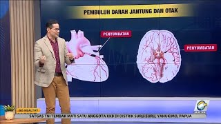 GO Healthy - Pentingnya Menjaga Kesehatan Pembuluh Darah