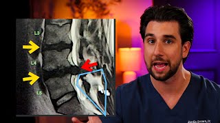 Your MRI Might Look Scary. This Is What It Actually Means