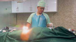 Penis Enlargement surgery Bangladesh | লিঙ্গ বড় করার পর রোগীর অভিজ্ঞতা